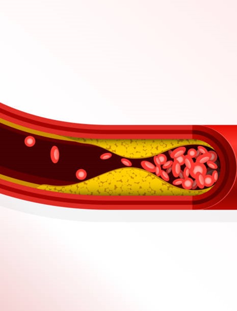 Istockphoto 2203550104 612X612